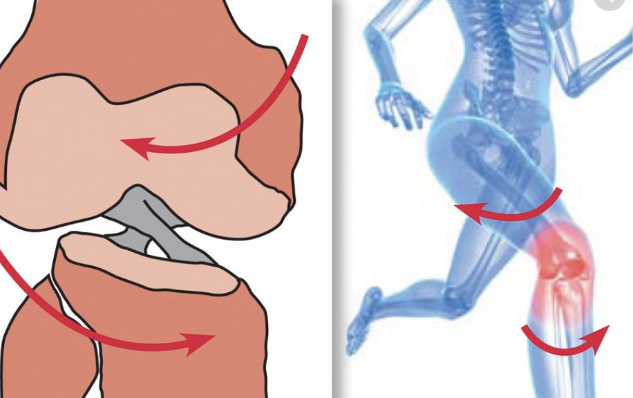 How to prevent acl tears in basketball